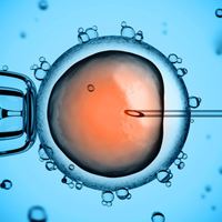 Schéma d’une fécondation in vitro ICSI montrant l’injection d’un spermatozoïde dans l’ovule