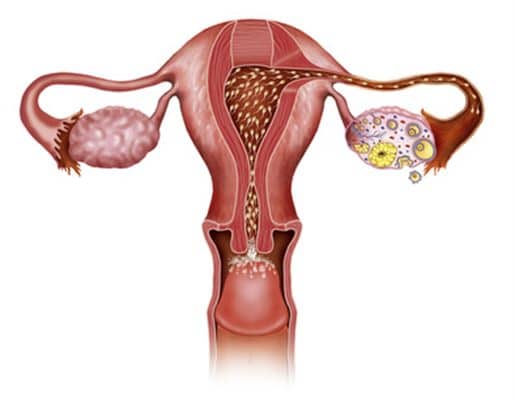Schéma de l’utérus, des trompes et des ovaires avec migration des spermatozoïdes vers l’ovulation