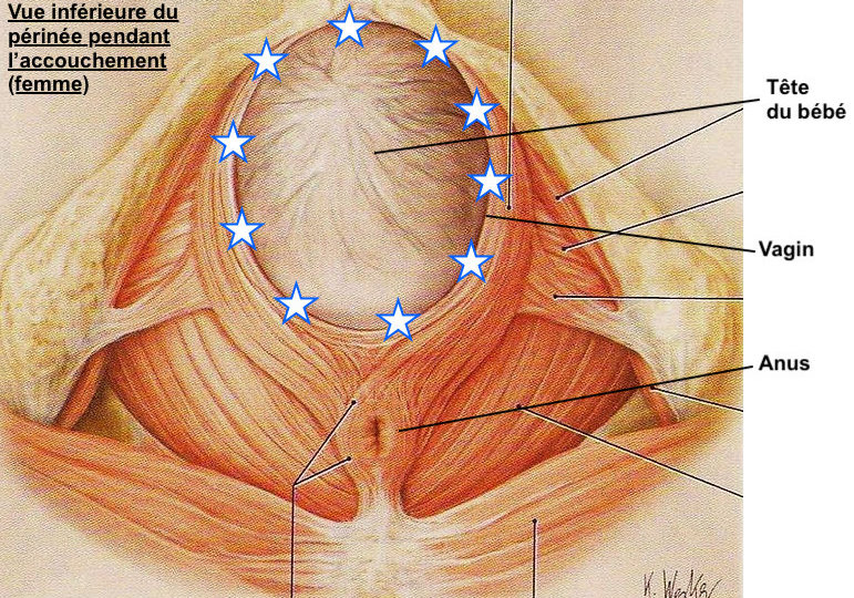 schéma illustrant une vue inférieure du périnée. Nous y voyons les différentes couches musculaires et l'étirement des fibres musculaires par la tête du bébé pendant l'accouchement. But de l'ostéopathe dans la préparation à l'accouchement : préparation du périnée par des étirements.