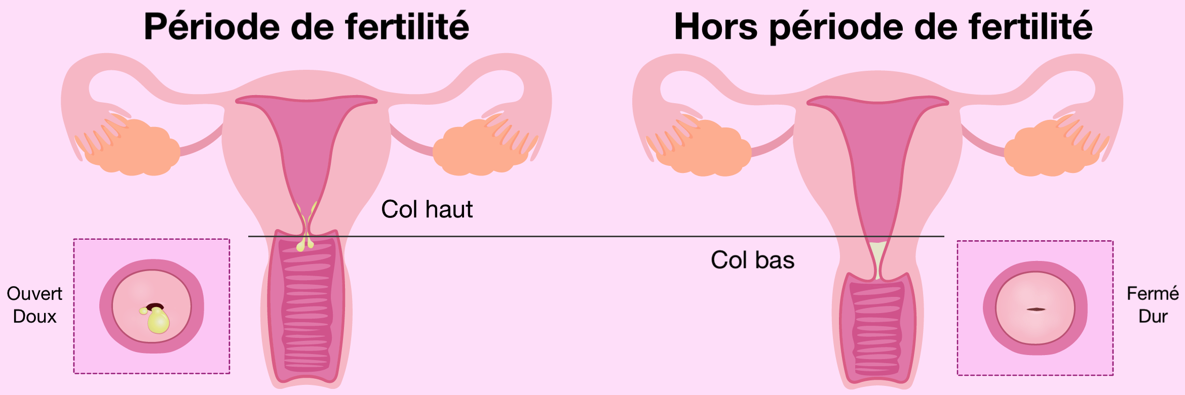 schématisation du col pendant la période de fertilité et hors période de fertilité. 